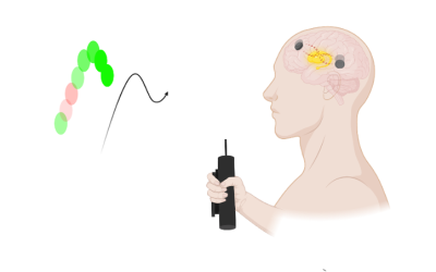 Non-invasive deep brain stimulation